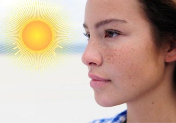 Ánh nắng mặt trời là nguyên nhân khiến collagen bị phá hủy